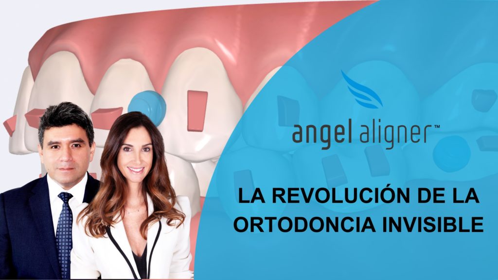 webinar Angel Aligner